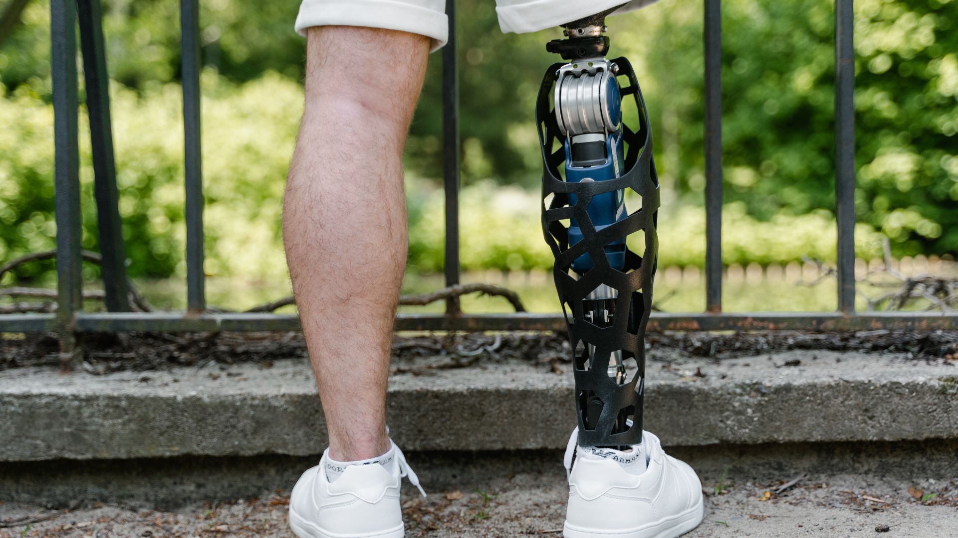 Advanced Prosthetic Solutions